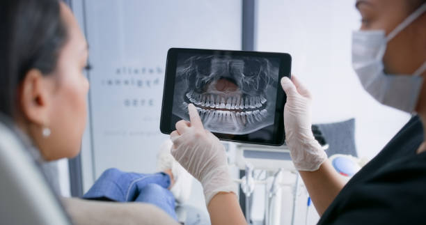 Licensed Dental Implants service in Mills County County, TX - Smile Center Dentistry